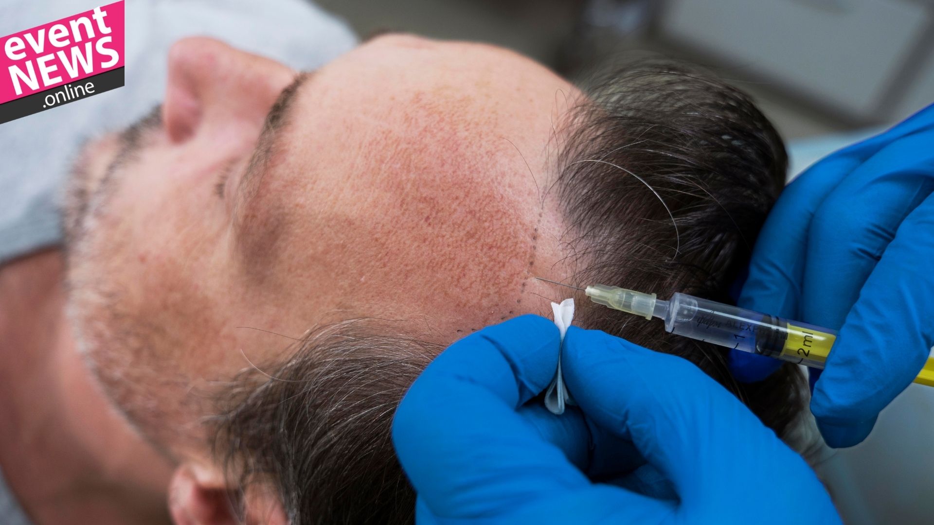 Türkiye, Pandemi Döneminde Dünyada En Çok Estetik Cerrahi Yapılan Ülkeler Arasında İlk 5'te